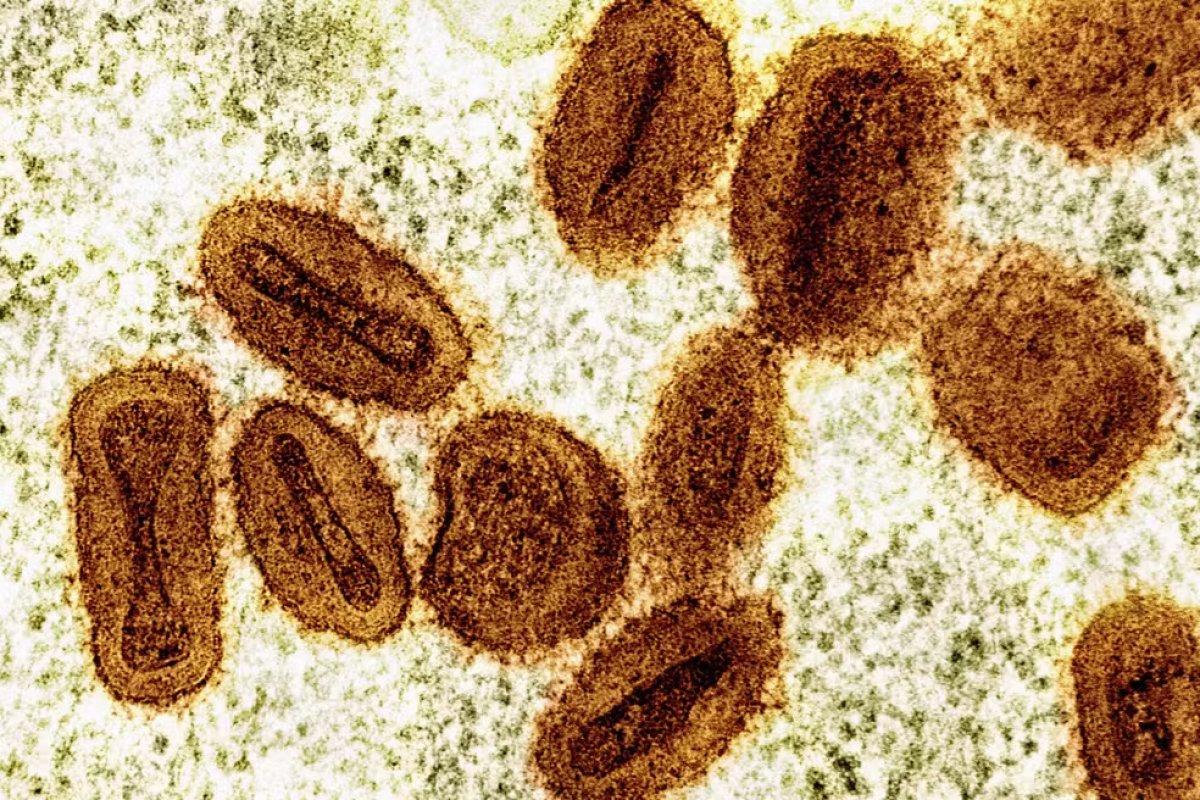 Vacina brasileira contra a mpox será submetida à Anvisa para obter autorização de testes em humanos