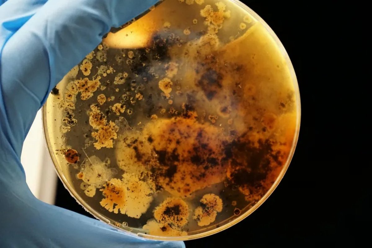 Resistência a antibióticos pode causar mais de 39 milhões de mortes até 2050, aponta estudo