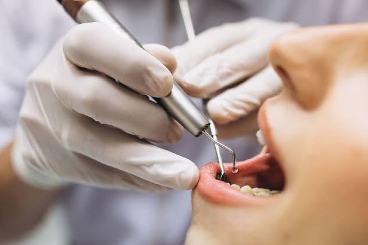 Dia Nacional da Saúde Bucal: qual o impacto da saúde bucal na autoestima e na qualidade de vida?  