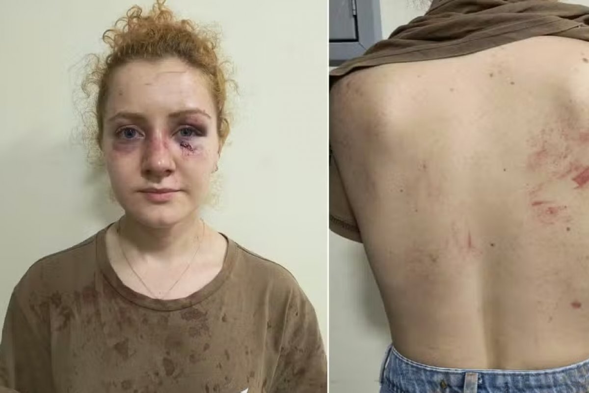 Jovem denuncia agressão após ser vítima de emboscada planejada pelo amigo de infância na Bahia
