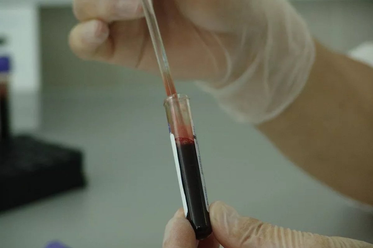 Cortes de verba no combate ao HIV podem causar explosão de casos e mortes até 2030 