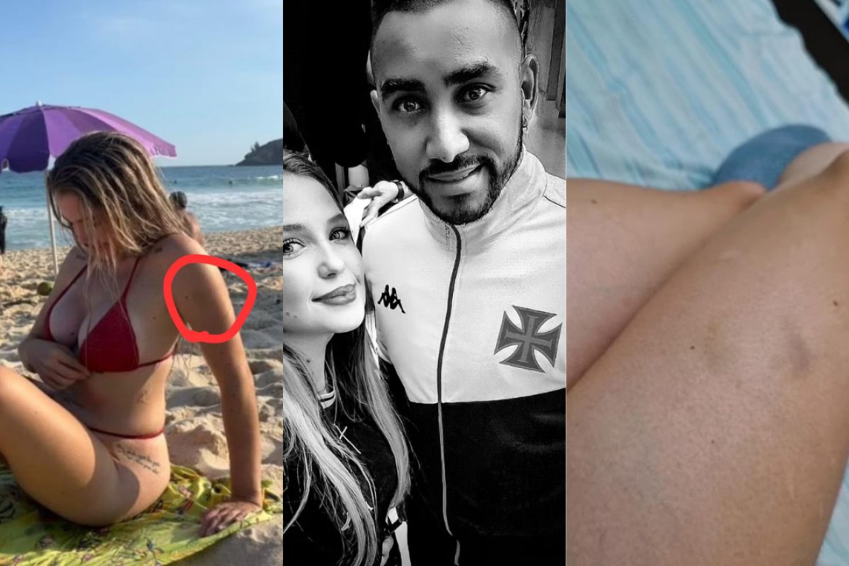 Jogador do Vasco, Dimitri Payet é investigado por violência contra advogada; veja imagens das agressões