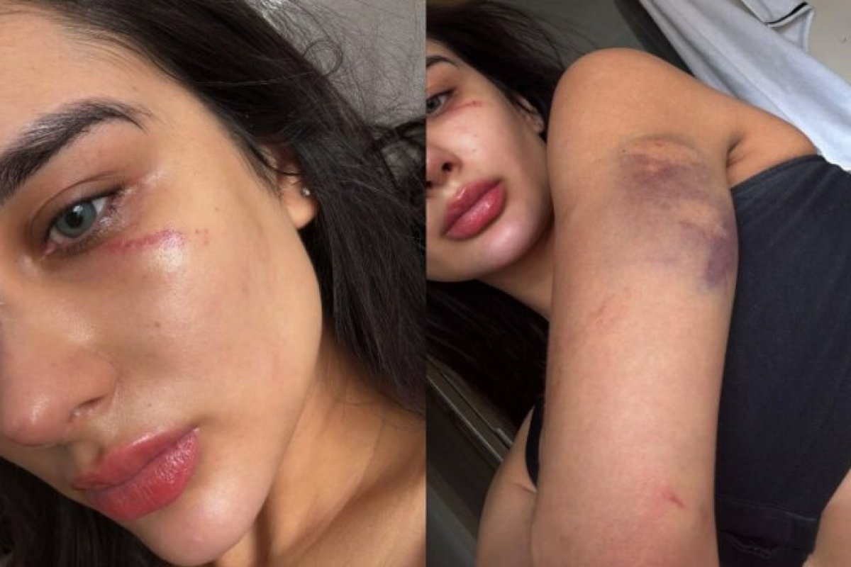 Miss Grand Amazonas denuncia agressões e ameaças feitas pelo ex-namorado 