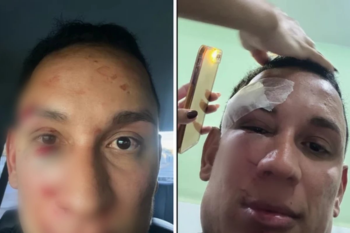 Cirurgião-dentista denuncia agressão física em camarote privado de São João da Bahia 