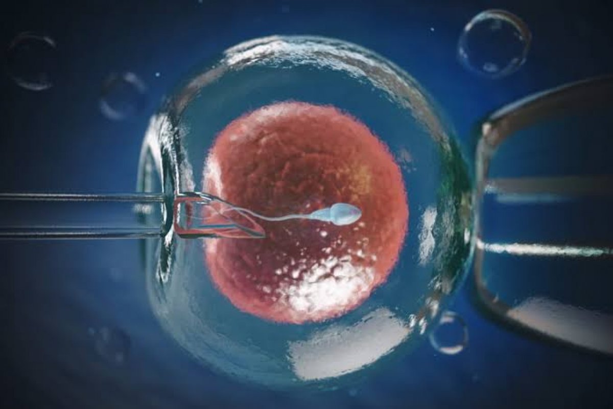 A cada 35 segundos, nasce um bebê por Fertilização In Vitro (FIV) no mundo!