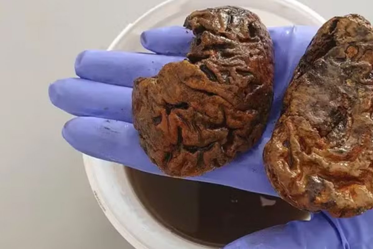 Cientista britânica coleciona e estuda cérebros de até 12 mil anos atrás 