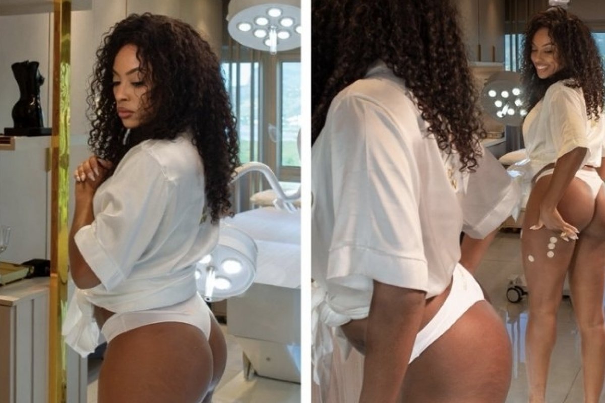 Lumena Aleluia aposta em bioestímulo de colágeno no bumbum como preparação para o Carnaval 2026! 