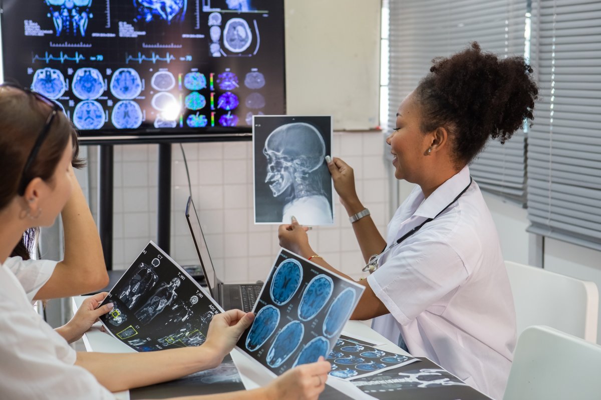 Tecnologia e agilidade salvam vidas: uso de IA faz diferença em casos de AVC!