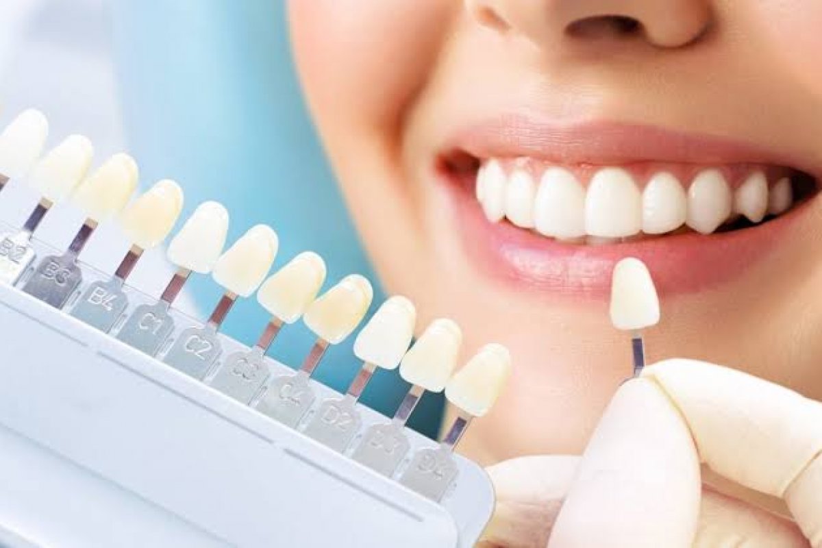 Curso de estética odontológica acontece na capital baiana! 