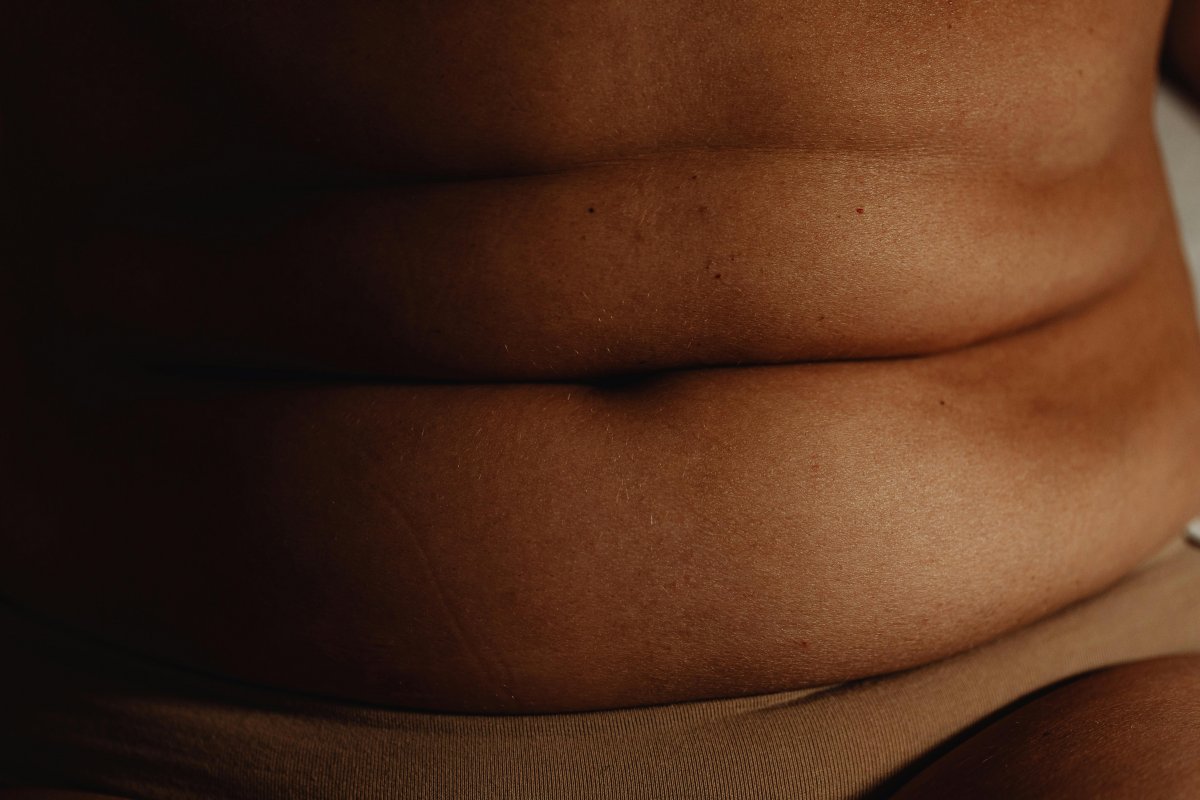 Gordura na barriga provoca danos cardíacos mais graves do que o peso total, aponta estudo