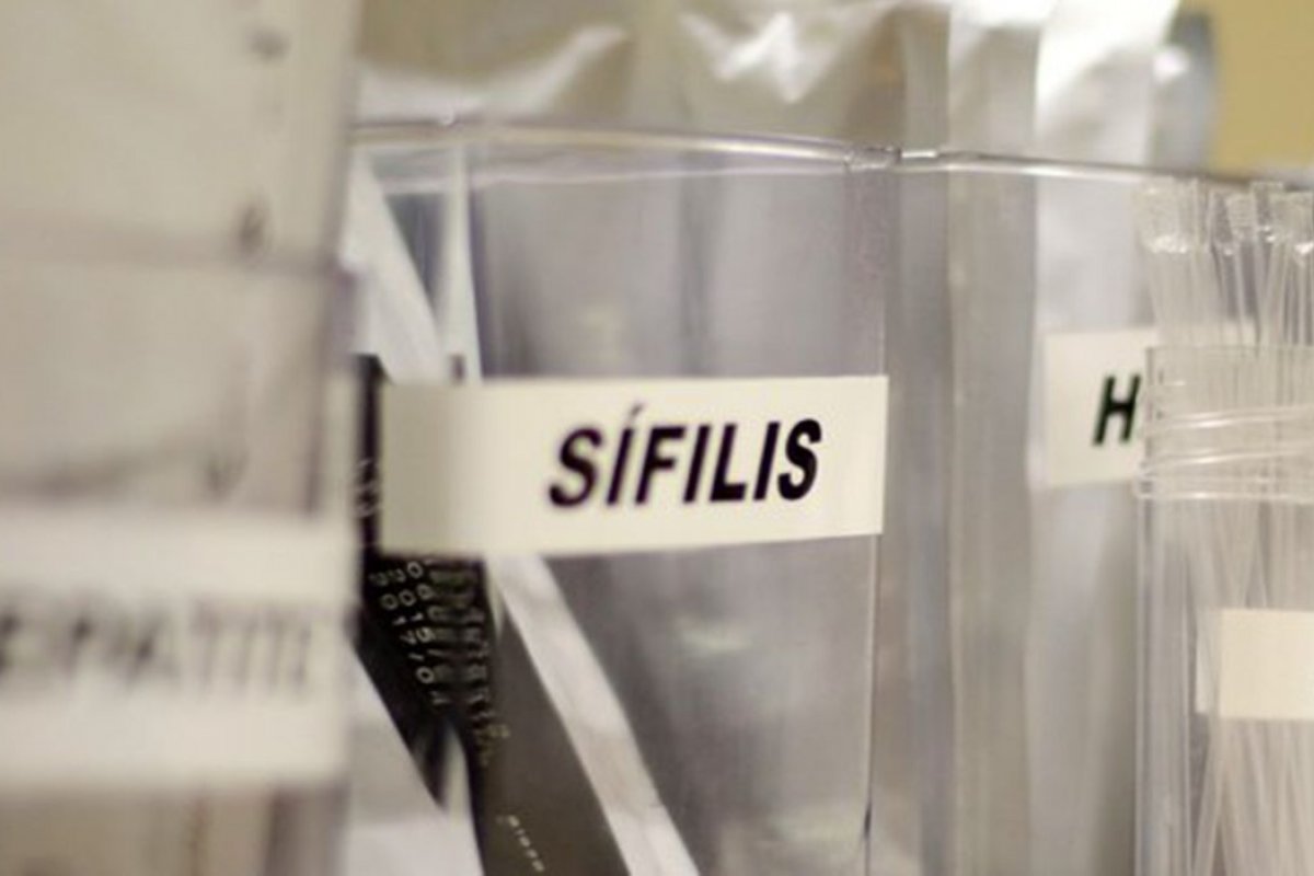 Sífilis continua em ritmo acelerado de crescimento no país