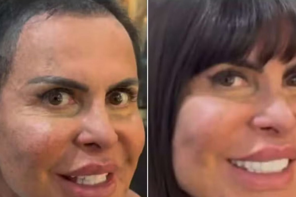 Gretchen volta a falar abertamente sobre a perda total do cabelo e esclarece os motivos que levaram à mudança radical em sua aparência!