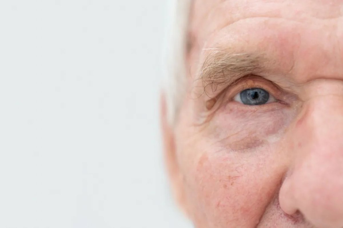 Tratamento inédito com células-tronco recupera parte da visão de pacientes com degeneração macular