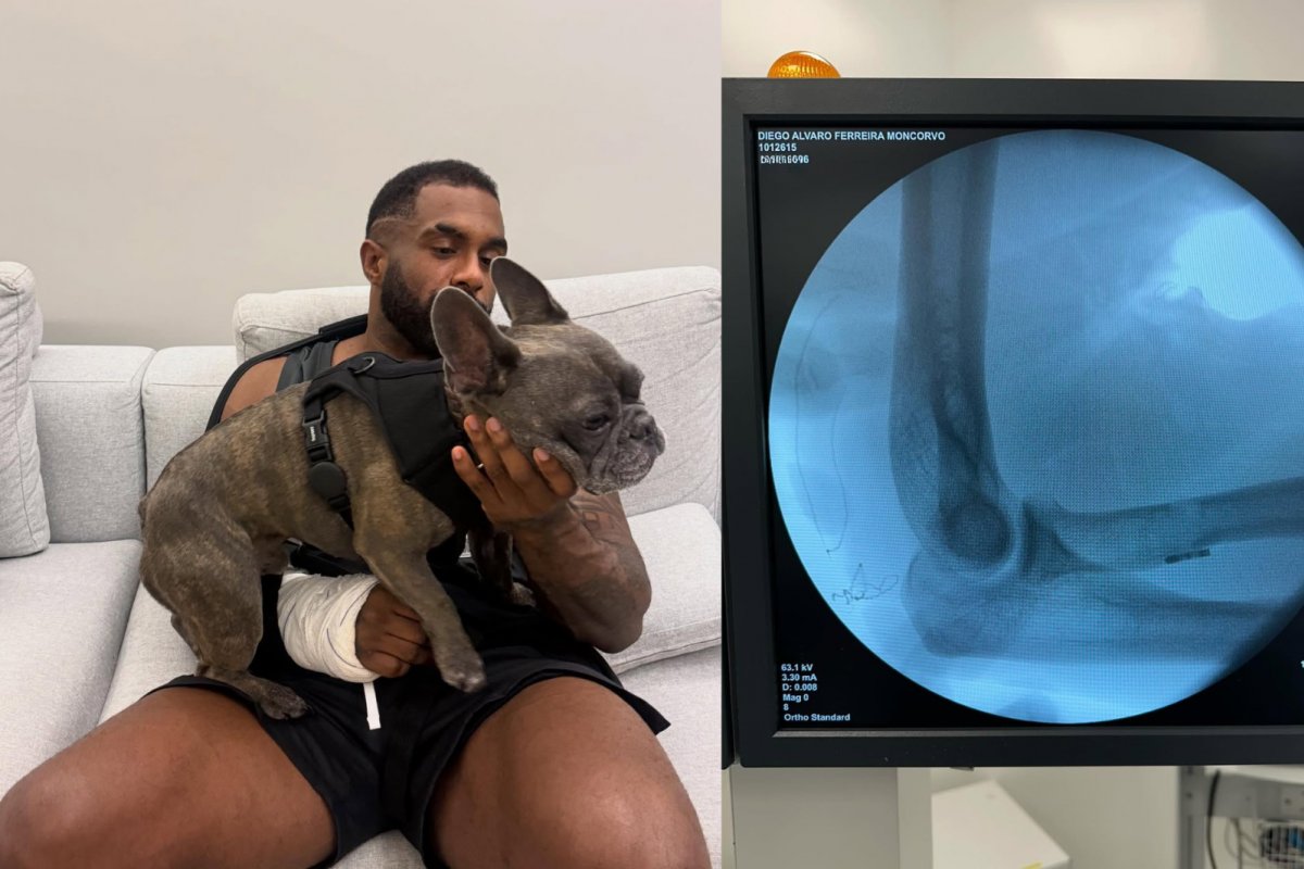Baco Exu do Blues usa redes sociais para tranquilizar fãs após cirurgia no bíceps: "Vou estar 'zero' na turnê"
