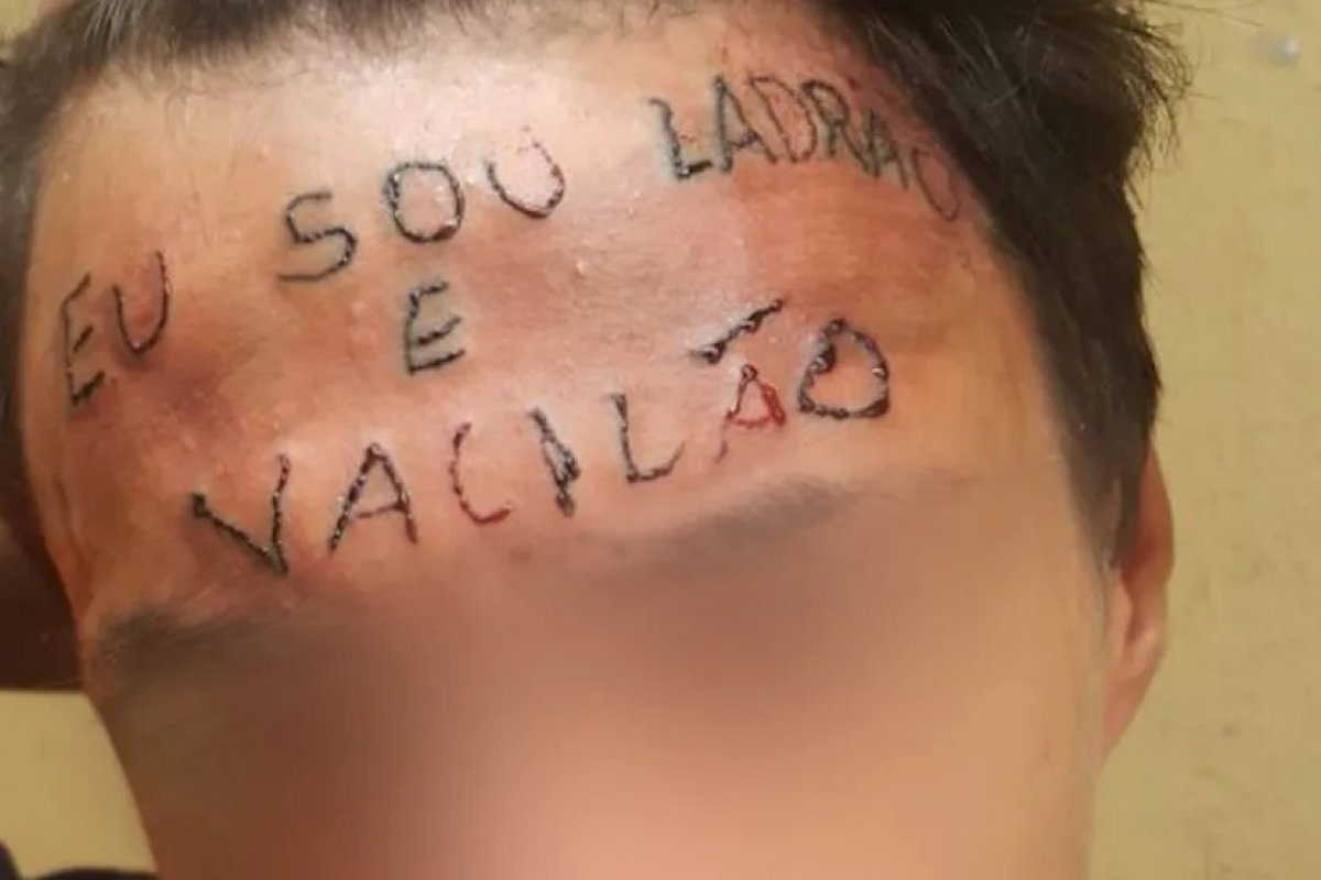 Jovem que teve testa tatuada com "eu sou ladrão e vacilão" é novamente preso em SP 