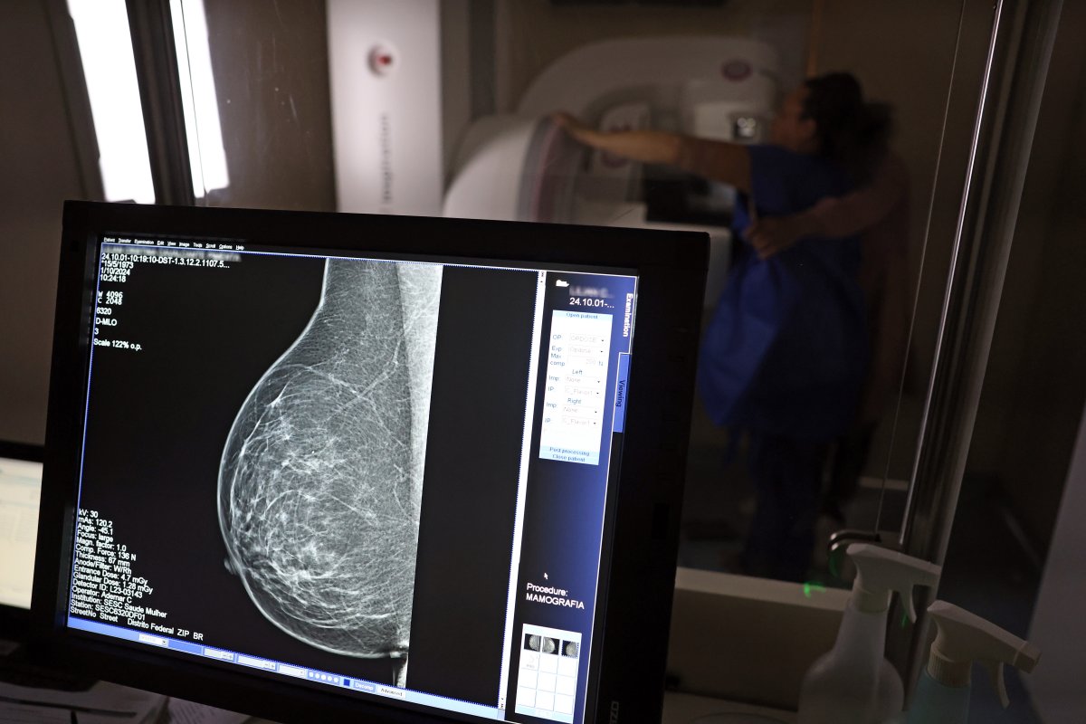 92% das brasileiras entre 50 e 69 anos fizeram mamografia, aponta sistema do Ministério da Saúde
