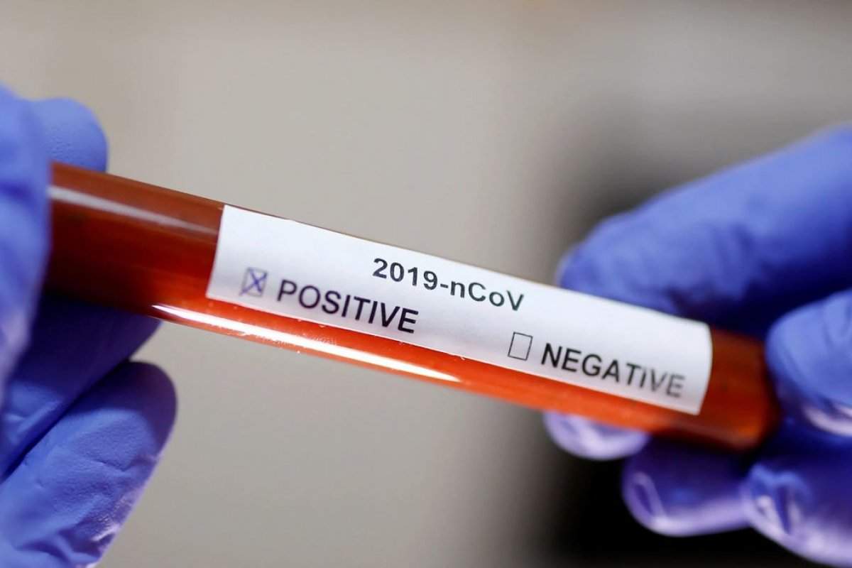 Pessoas infectadas pelo coronavírus no mundo ultrapassa marca de 100 mil, aponta levantamento