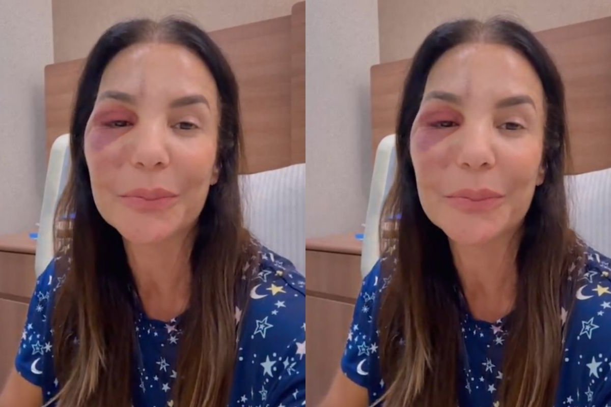 VÍDEO: Ivete tranquiliza fãs sobre cirurgia realizada neste domingo (1)