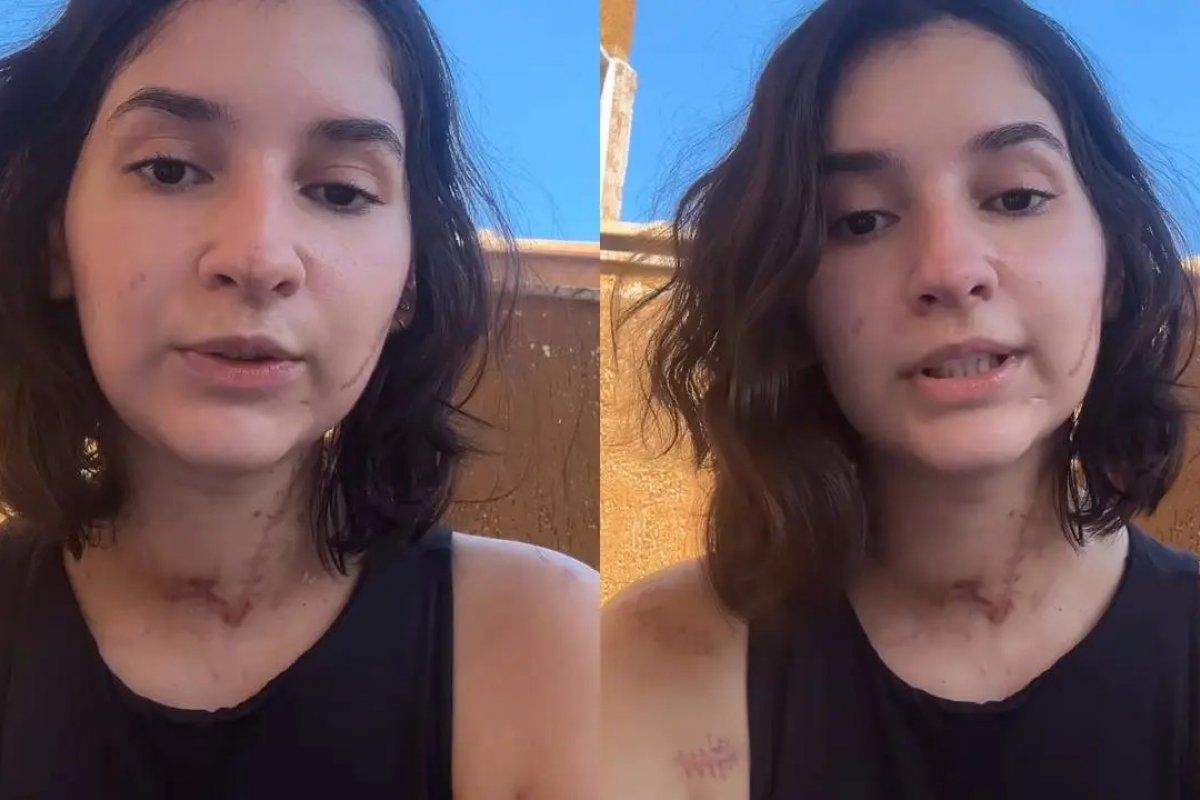 Mais de 10 facadas: sobrevivente de tentativa de feminicídio fala pela 1° vez; veja