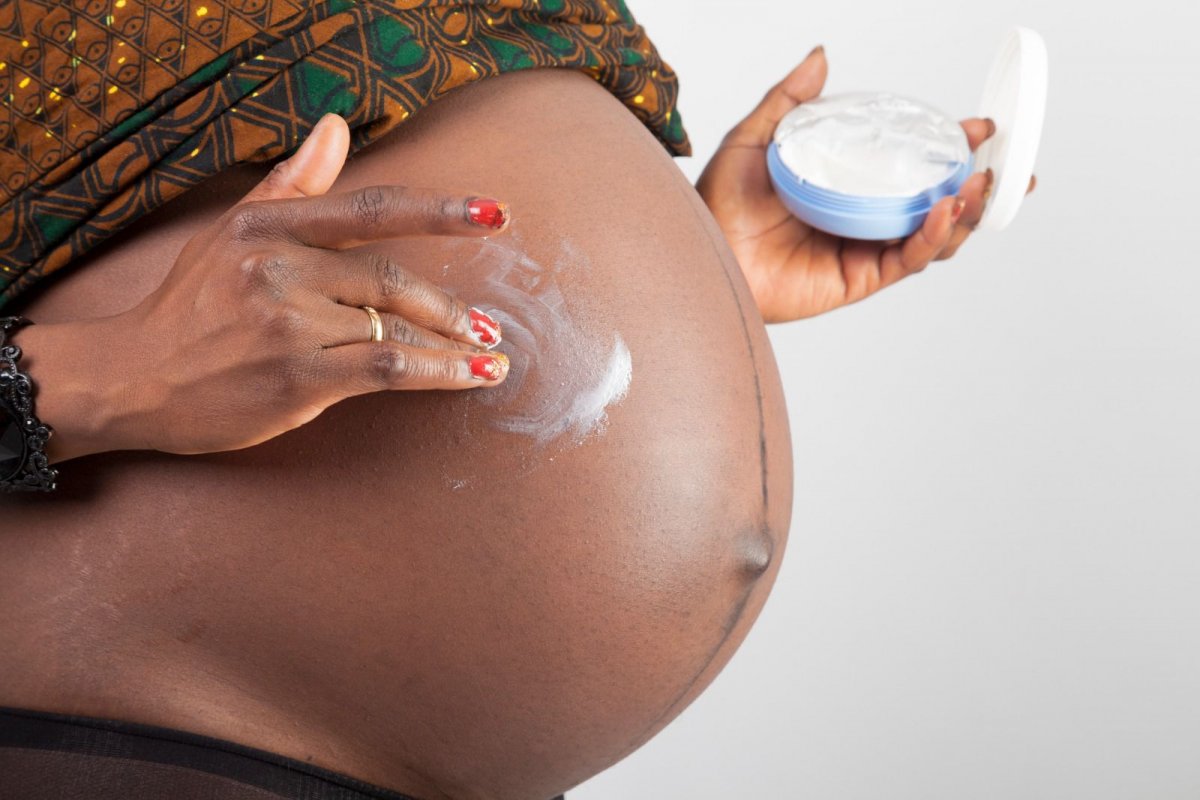 Manchas na maternidade: por que o melasma atinge até 75% das gestantes e como tratá-lo 