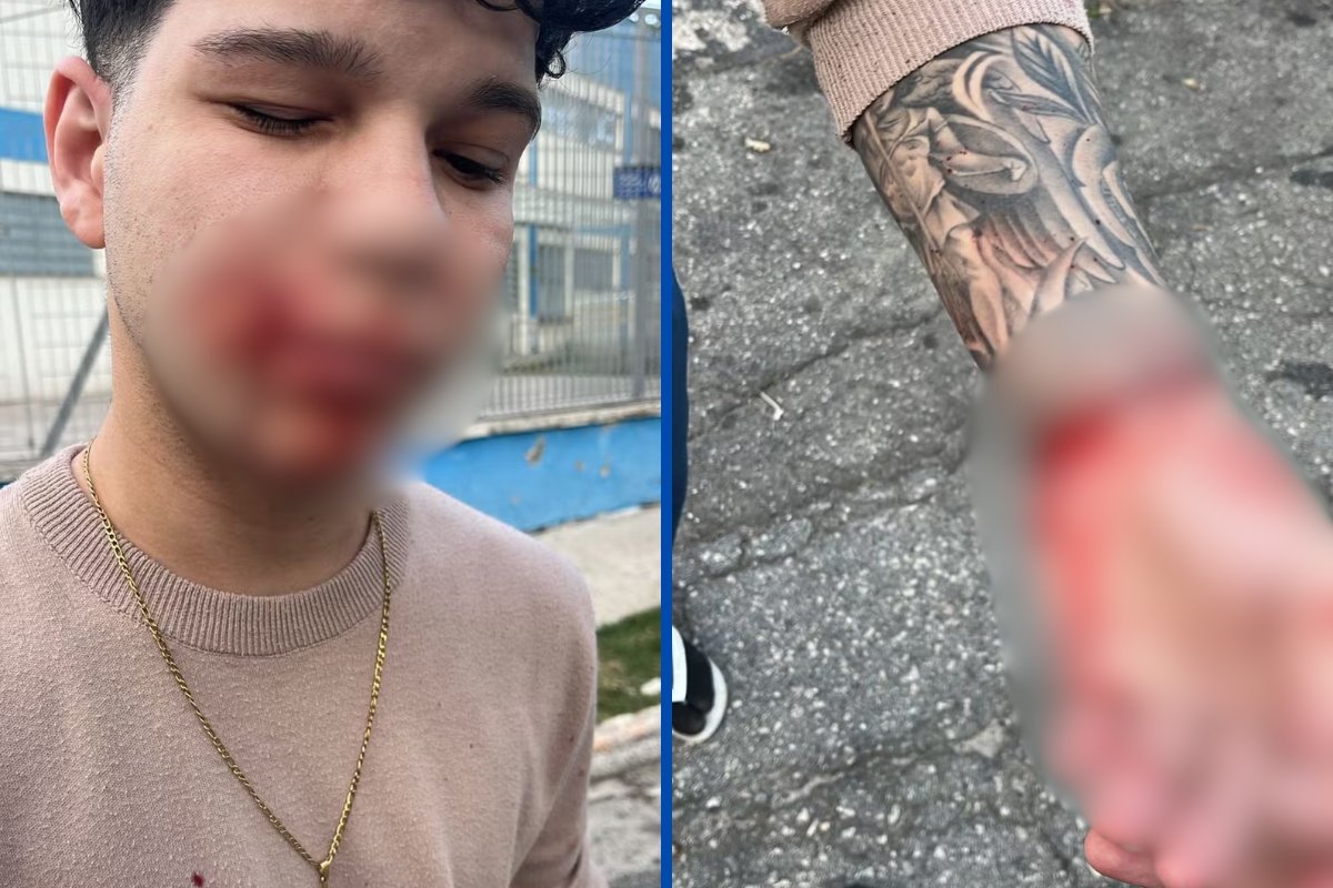 Vídeo: 'A janela explodiu na minha cara': narra jovem vítima de explosão que atingiu imóveis em São Paulo