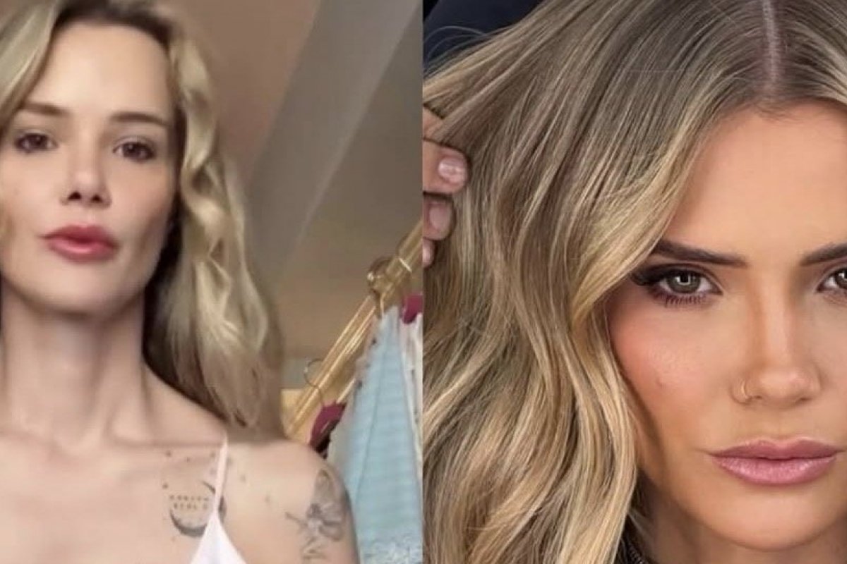 Marcela Mc Gowan fala sobre “rippling” nas próteses após emagrecimento e especialista explica o efeito! 