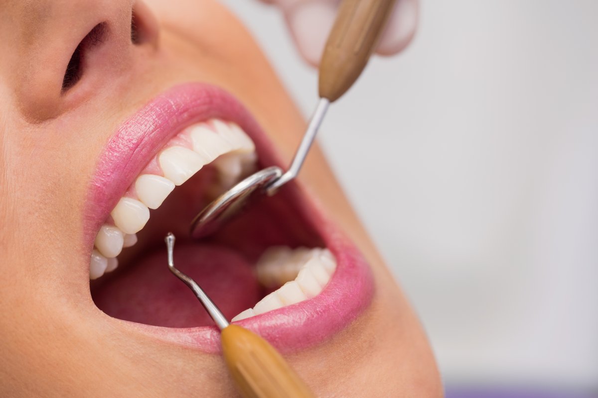 Procura por procedimentos odontológicos cresce até 30% antes do São João, afirma dentista!