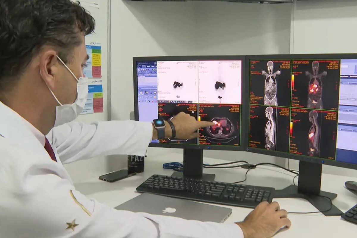 SUS passa a oferecer novo exame para detectar câncer de intestino antes dos sintomas