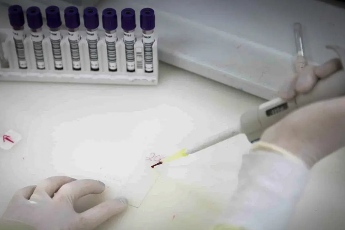 Secretaria de Saúde de SP descarta suspeita de Ebola em imigrante da República Democrática do Congo