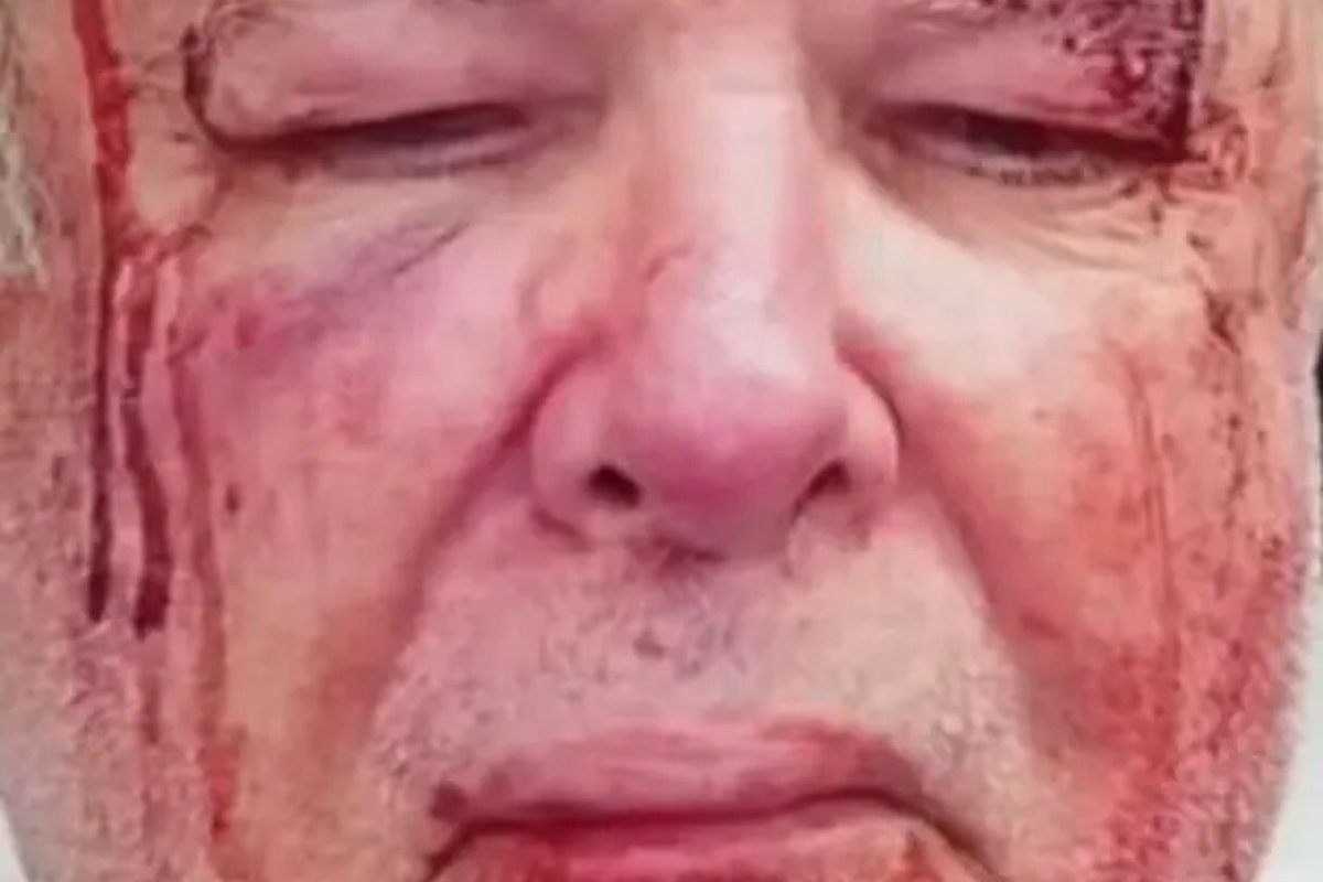 "Eles iam me matar", diz eleitor do PT agredido por três pessoas em Copacabana