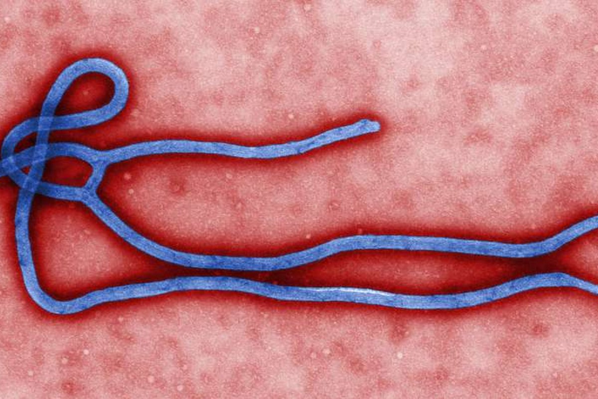 Primeiro caso de ebola é confirmado na França