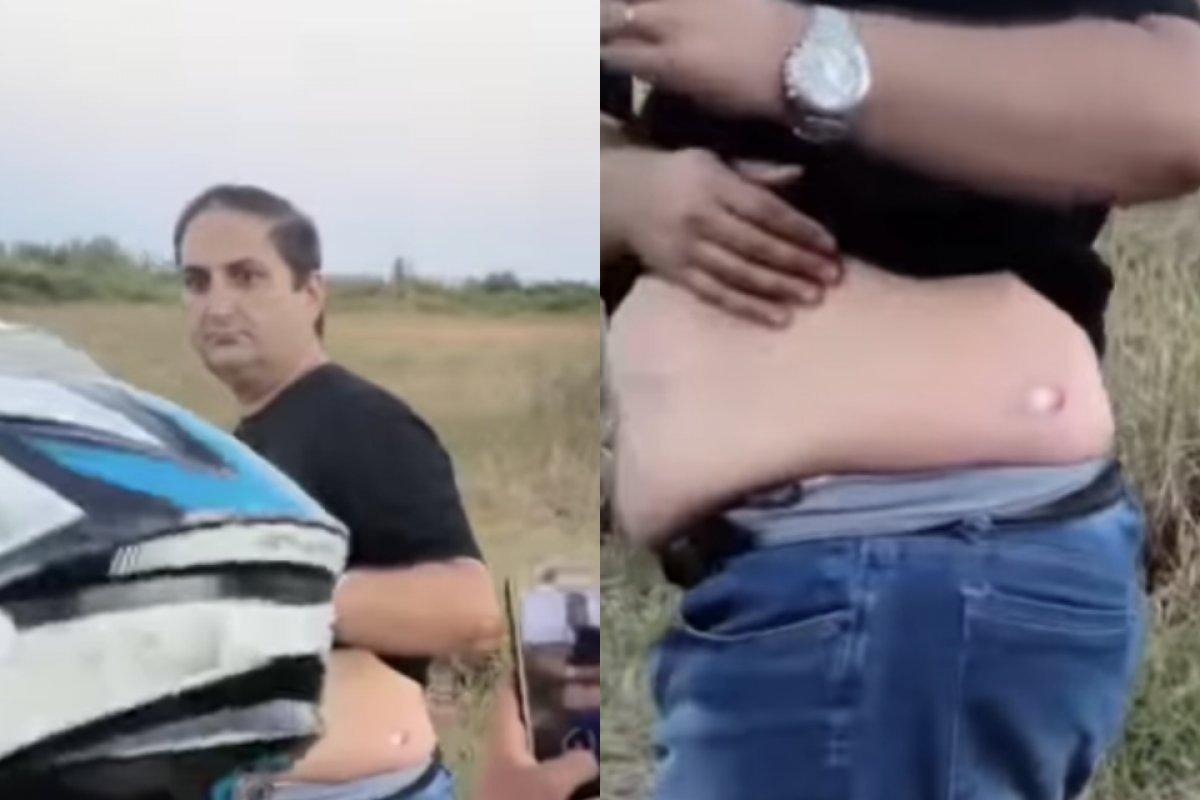 Vídeo: Candidato ao governo da Bahia é atingido por bala de borracha em manifestação e acusa PM