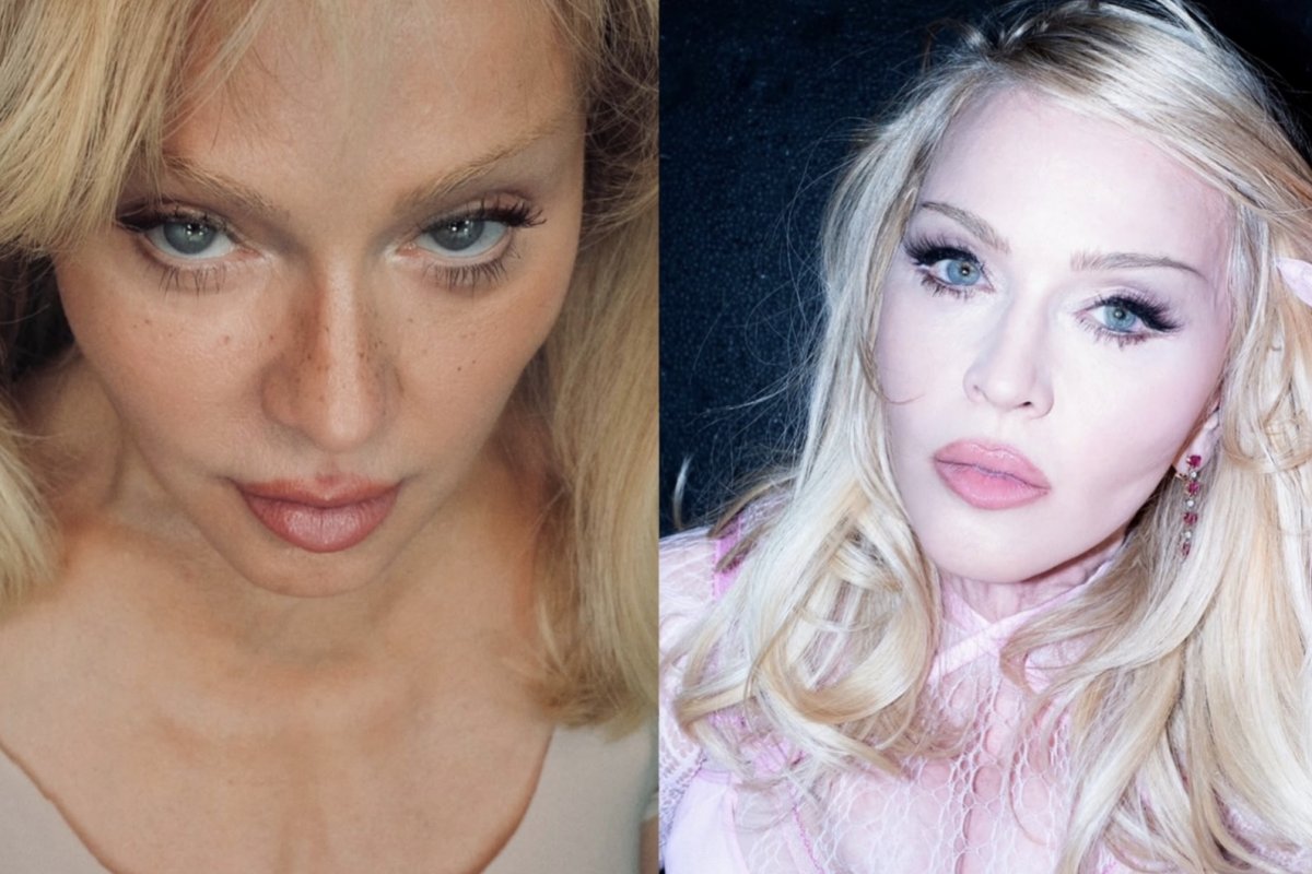 Madonna aos 68: O que explica a aparência tão jovem da cantora!