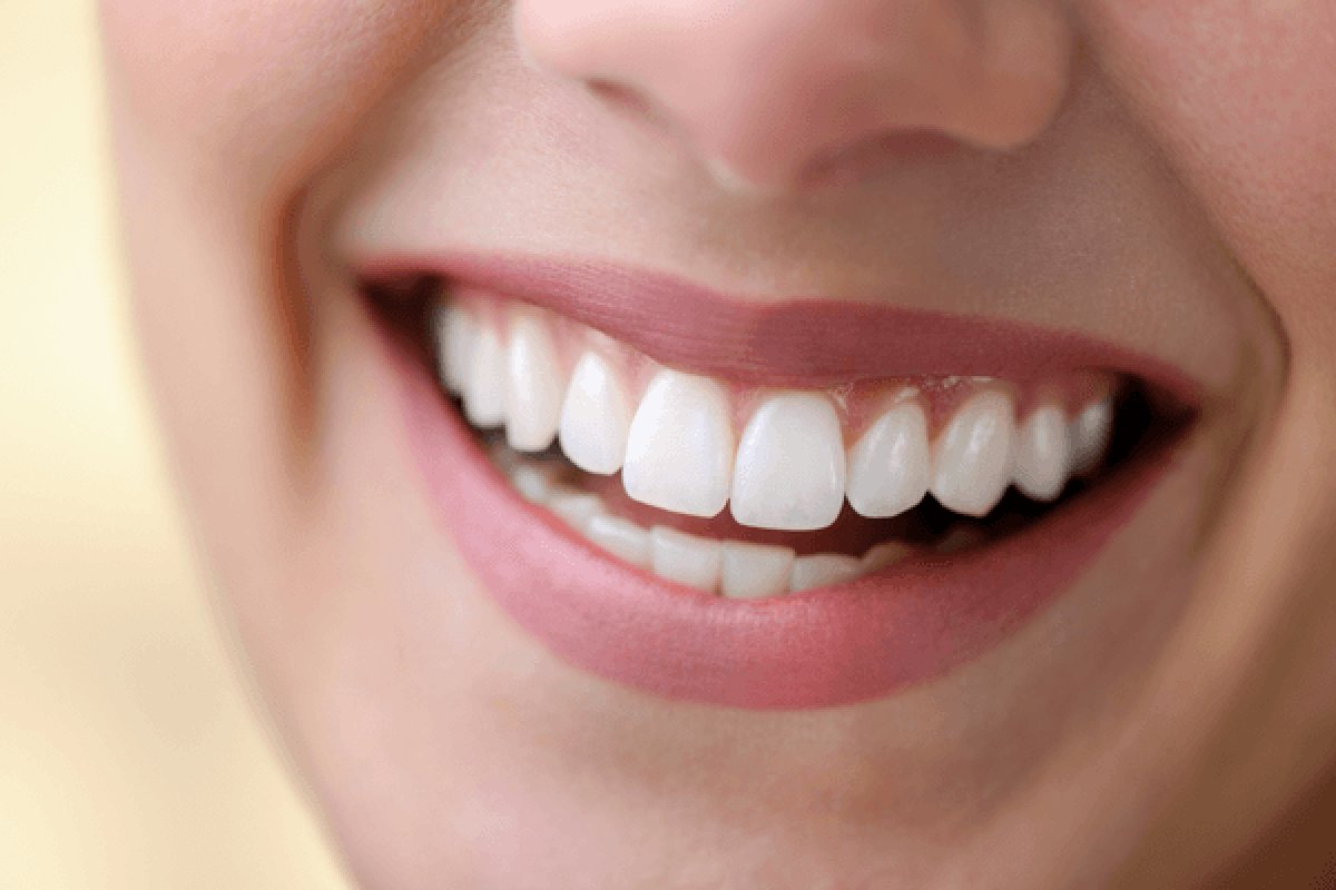 Planejamento individualizado valoriza as características de cada pessoa na odontologia estética! 