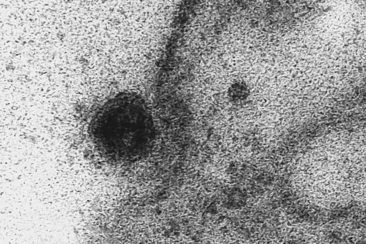 Vídeo: Veja como uma célula é infectada pelo novo coronavírus