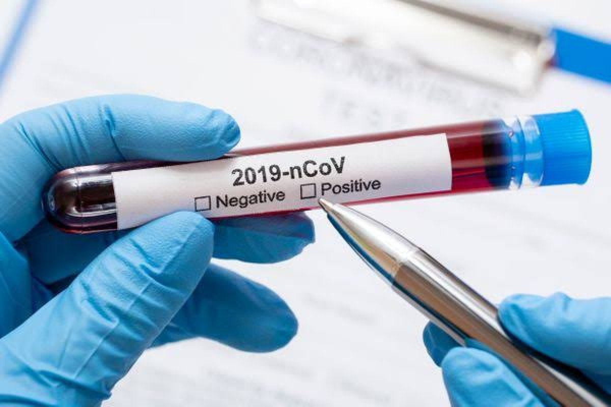 Brasil é o país que menos realiza testagem entre os atingidos pela Covid-19