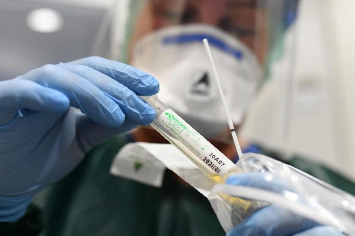 Instituto desenvolve teste rápido que detecta a covid-19 em um minuto