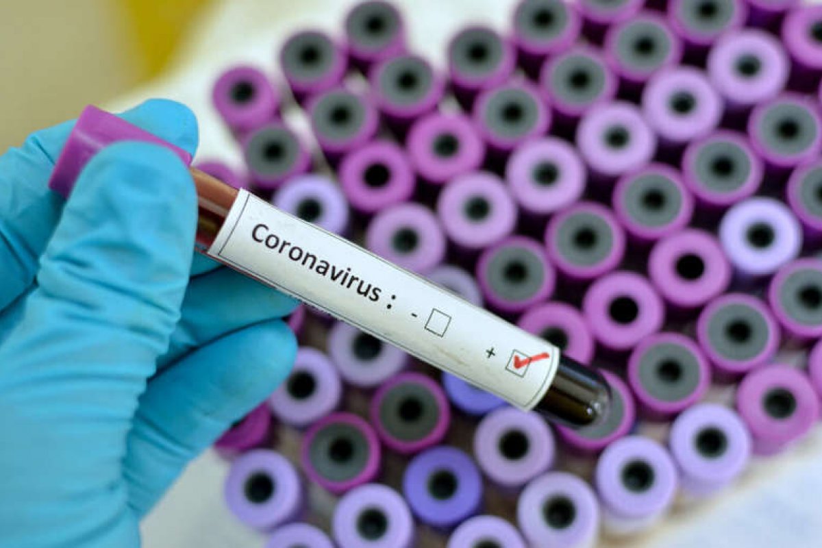 Bahia registra 884 casos confirmados de Convid-19