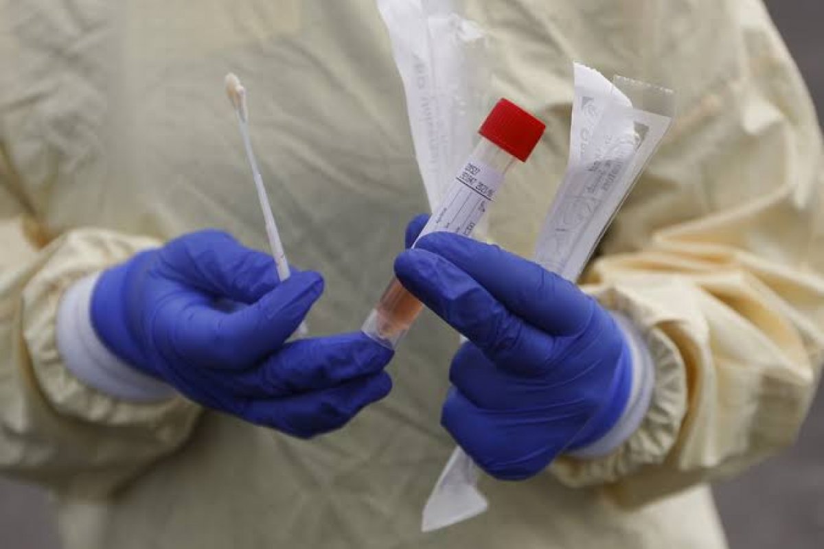 80 mil testes de Covid-19 são comprados pelo Governo da Bahia