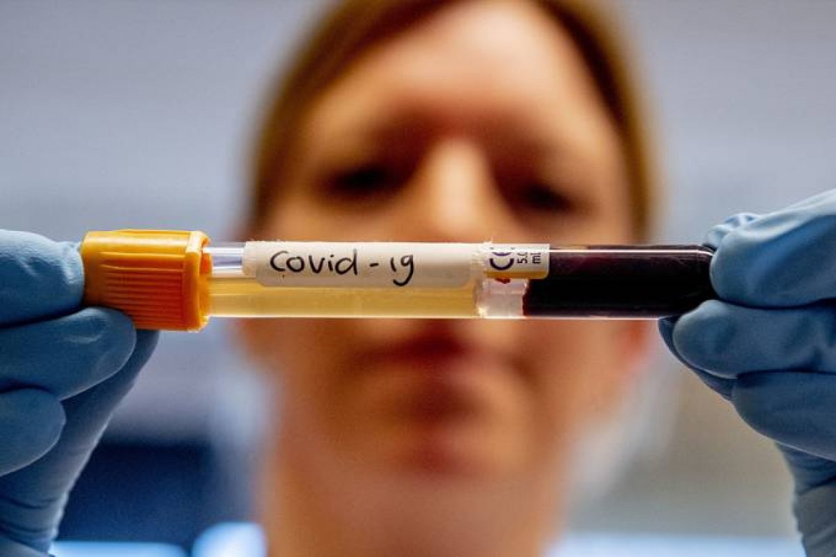 Infectados pela Covid-19 no RJ são os primeiros no Brasil a receber tratamento com plasma sanguíneo