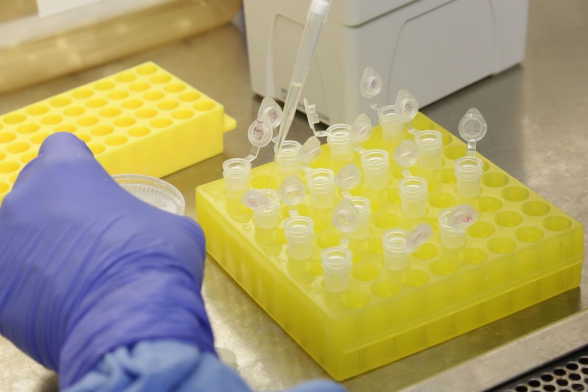 Chegam ao Brasil 500 mil testes para diagnóstico da covid-19