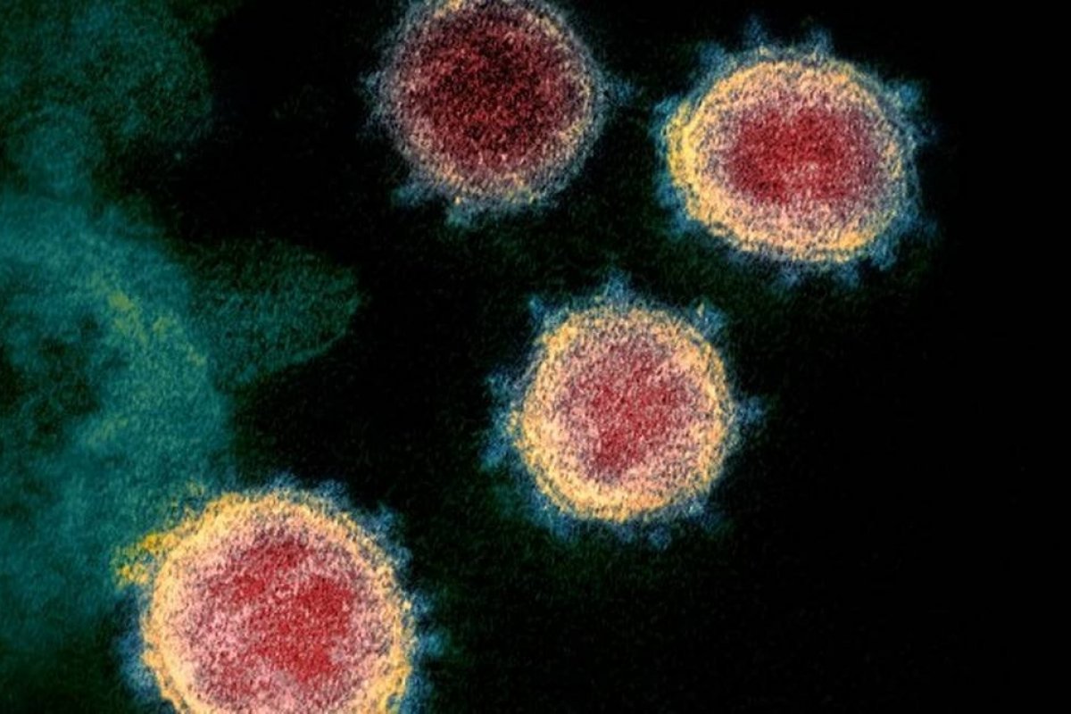 Grupo de pesquisa recruta voluntários para se infectarem com o novo coronavírus