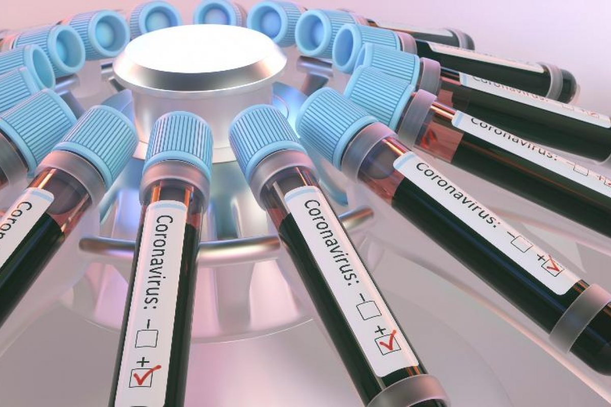 Cientistas dos EUA afirmam ter teste de Covid-19 barato 