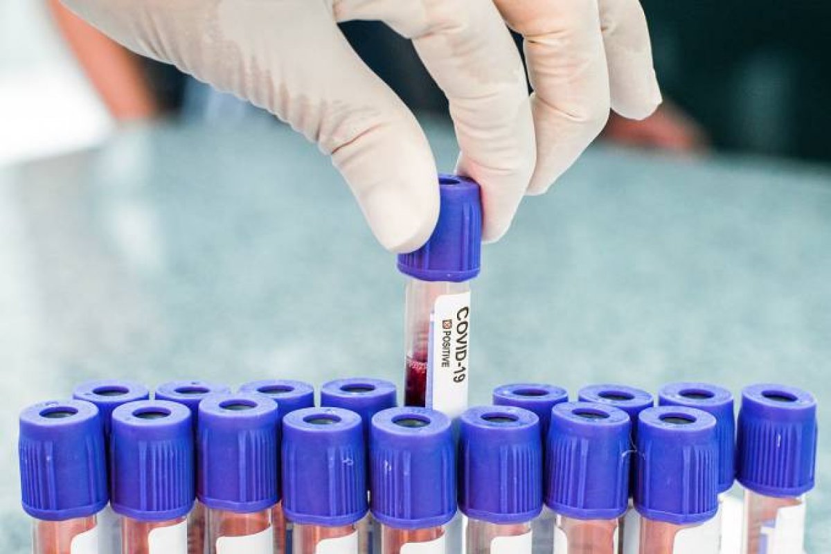 Vacina contra a Covid-19 pode ficar pronta em setembro, afirma Pfizer e NYU