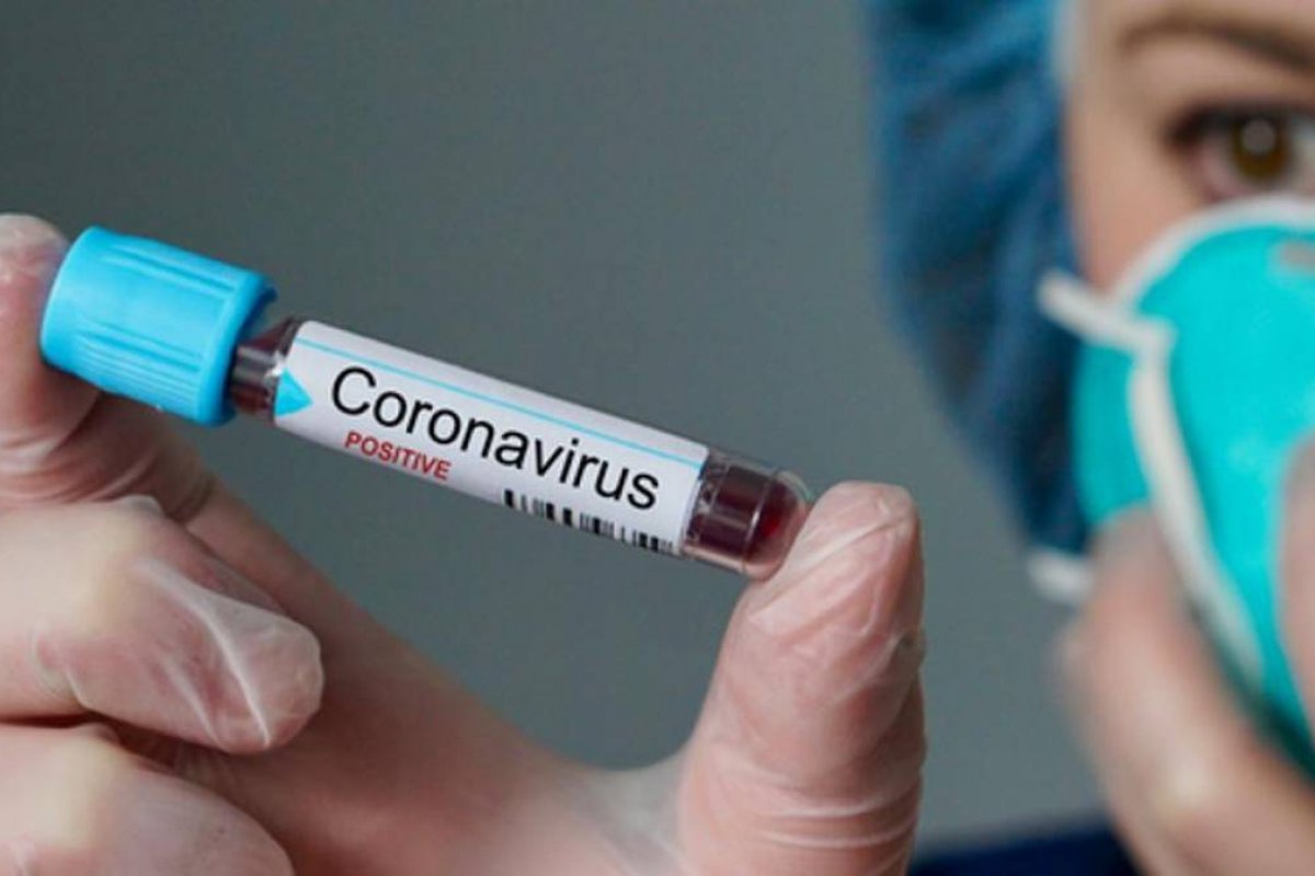Ministério da Saúde reforça estratégias para identificar coronavírus rapidamente nos municípios