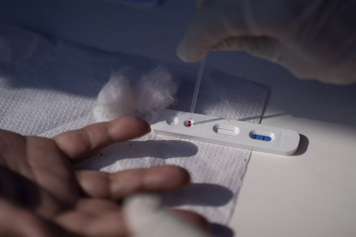 Covid-19: Mais de 1,2 mortes são registradas por dia no Brasil