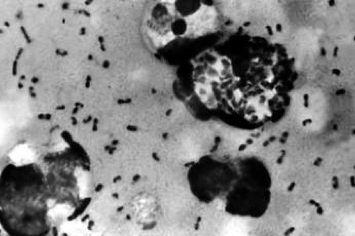 Peste bubônica  aparece na China e gera alarme em países da Ásia Central