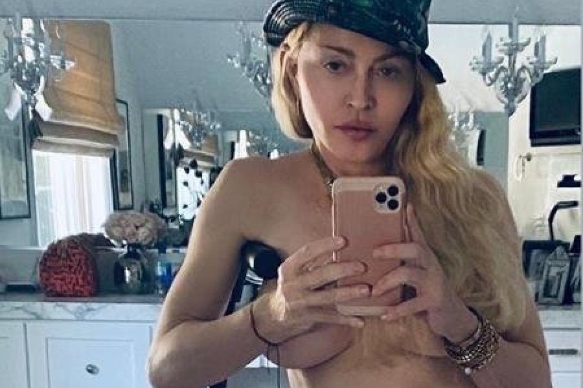 Madonna faz topless usando muletas e agita web 