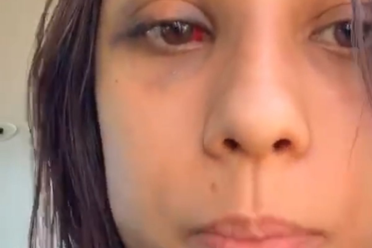 Vereador de Campo Formoso é acusado de espancar a própria filha 