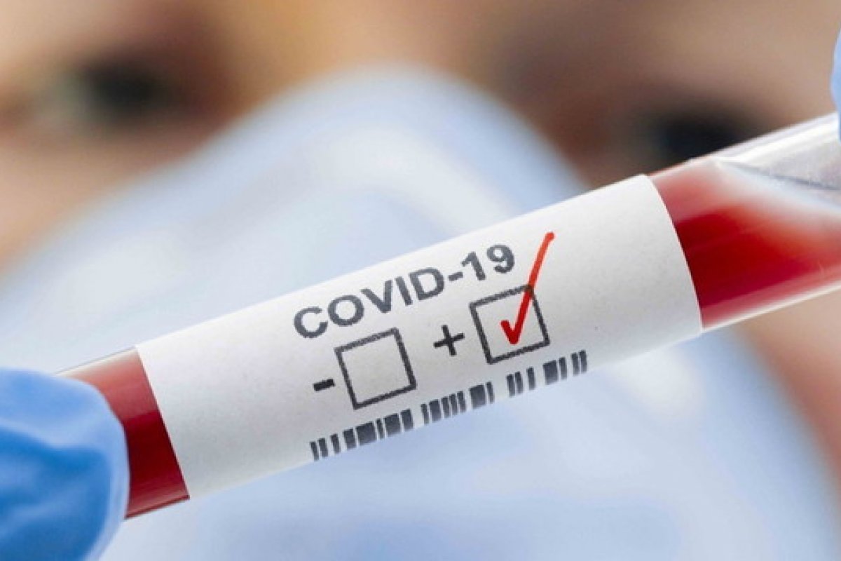 Brasil: nove estados avançam em casos confirmados e 10 disparam em mortes pela Covid-19